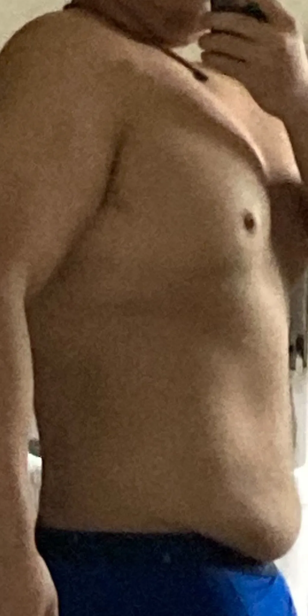ビフォー